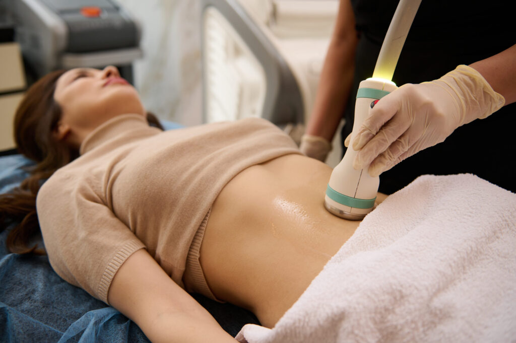 What is Body Sculpting, and Does it Work