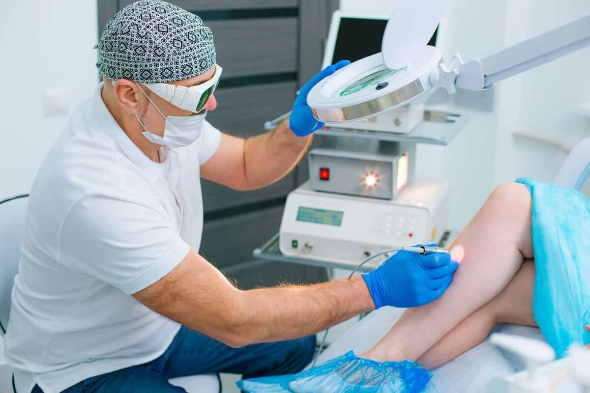 Spider Vein Treatment by Gentle Giant Care in Atlanta GA