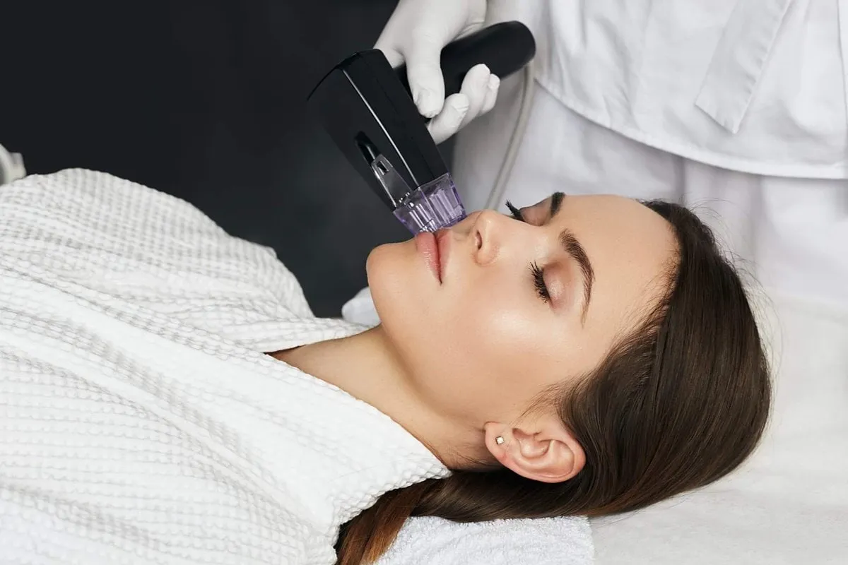 "Patient receiving Morpheus8 treatment for facial skin tightening and rejuvenation."