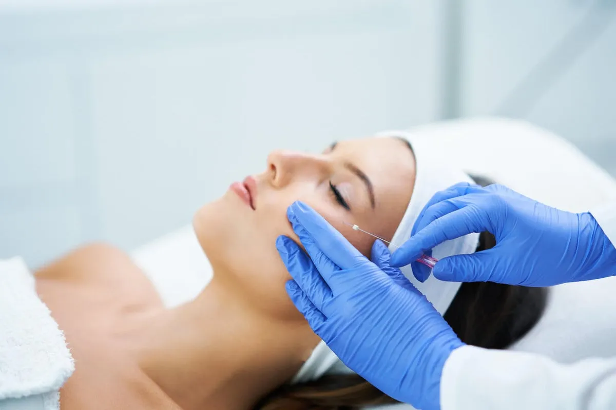 "Patient undergoing thread lift procedure for facial rejuvenation."