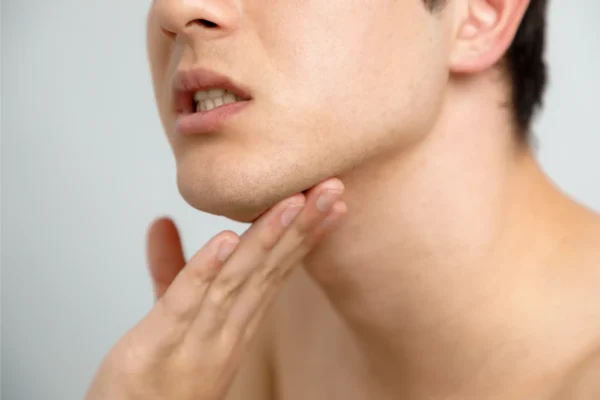 botox-wrinkle-relaxers-treatment-TMJ-gentle-giant-care-llc-CA-in-atlanta-ga