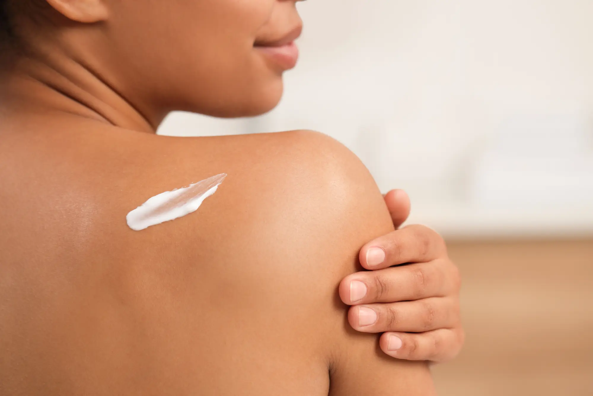 Chemical peel treatment on shoulder at Gentle Giant Care, CA