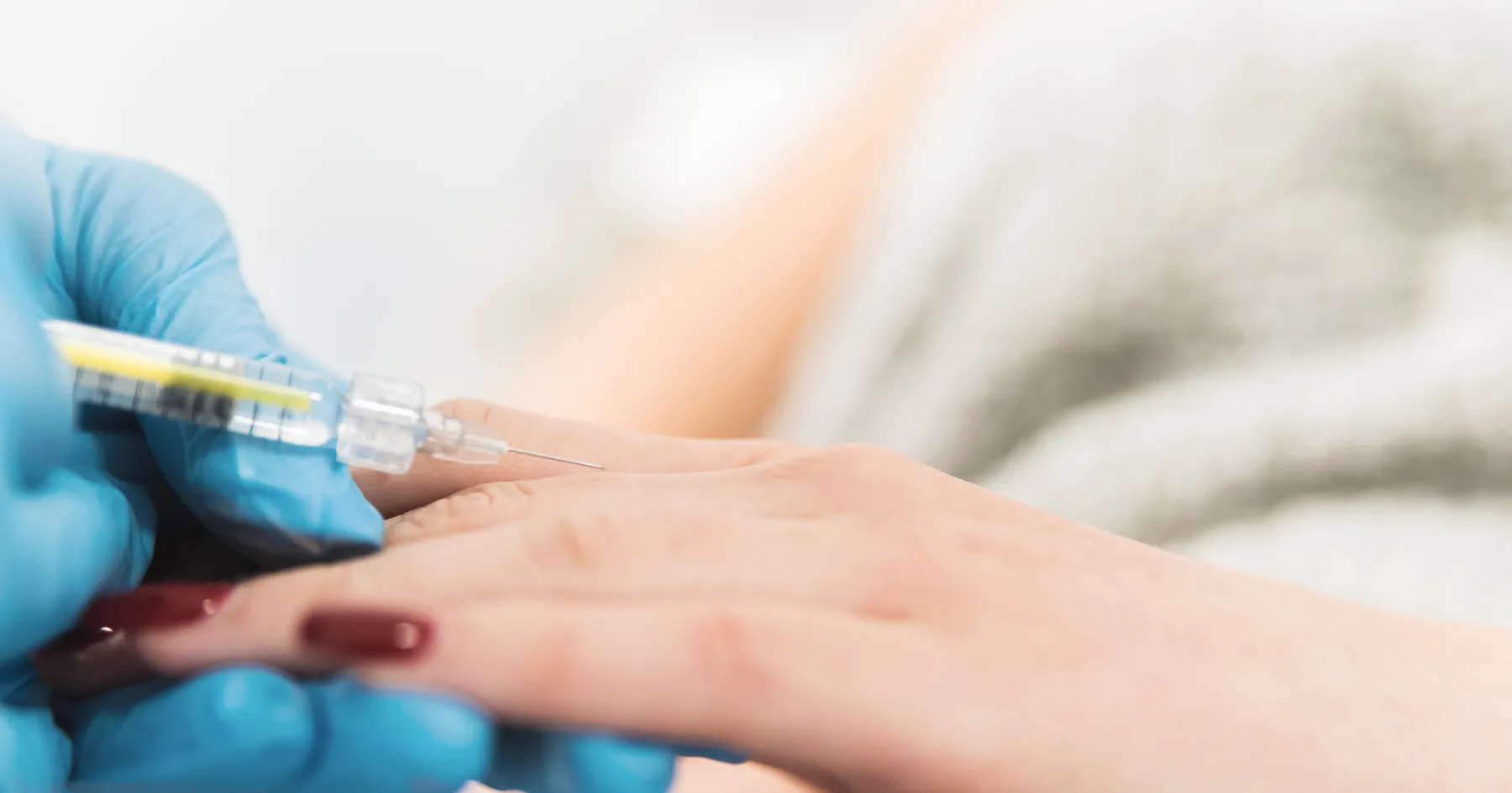 Hand dermal filler