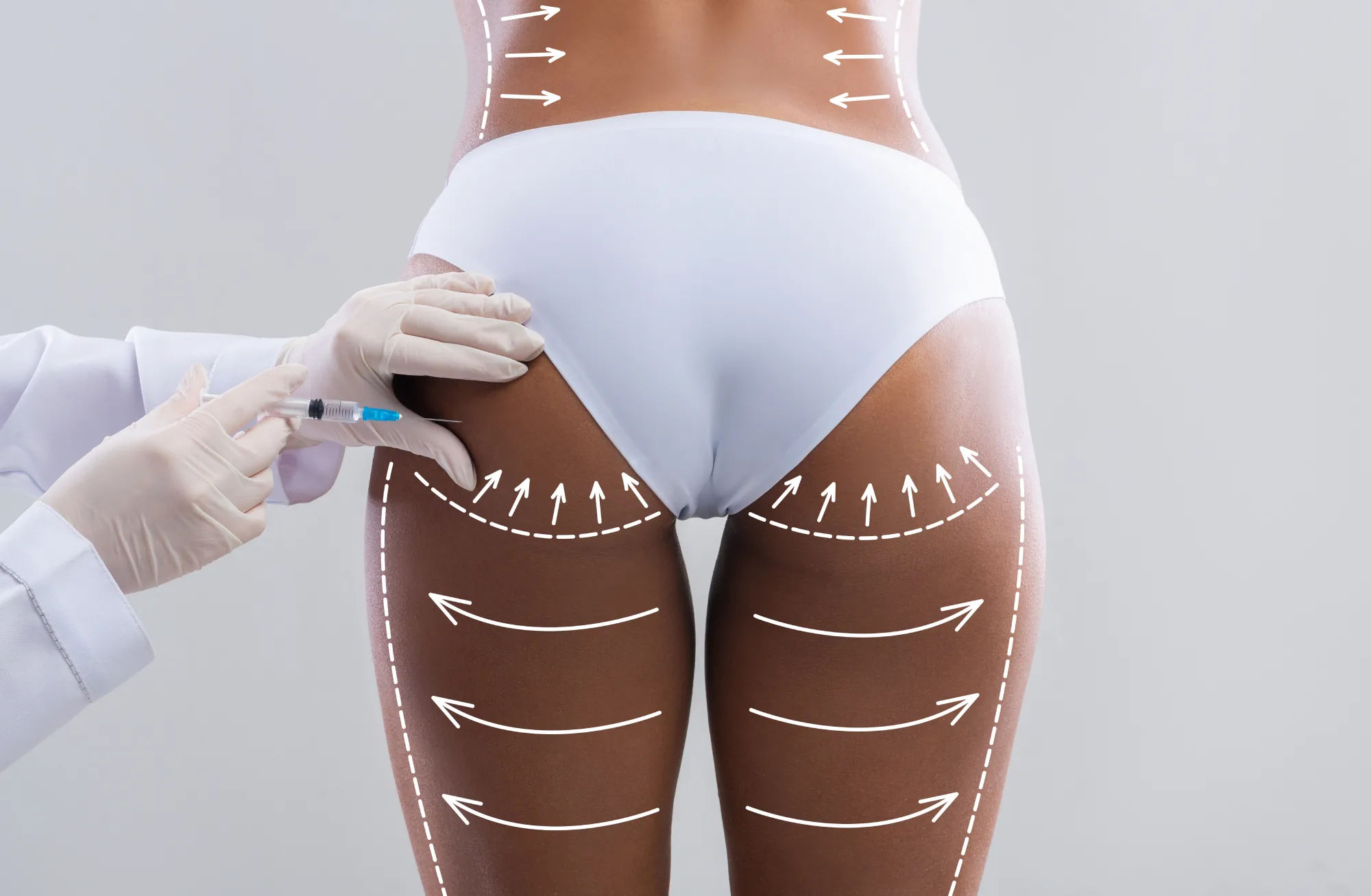 Glute enhancement treatment
