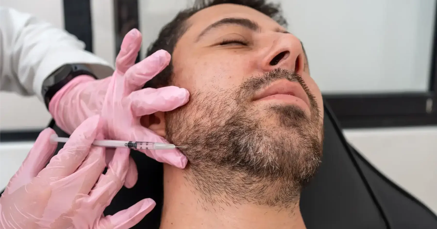 Jawline filler treatment to enhance definition and contour at Gentle Giant Care LLC in Palm Springs, CA.