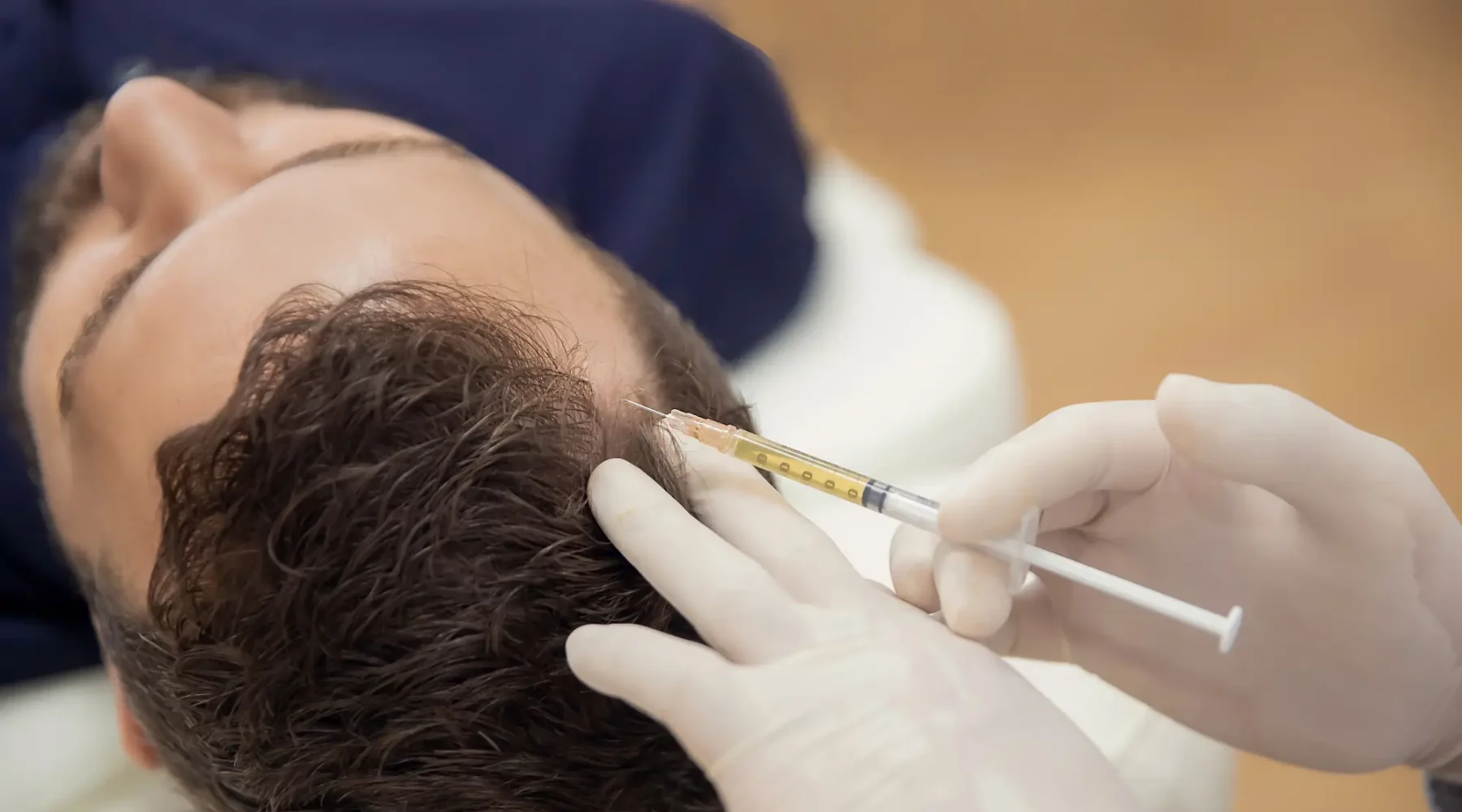 “Stem cell and PRP injections for hair restoration at Gentle Giant Care LLC in Palm Springs, California — a clinician administering regenerative therapy to the scalp to promote hair growth and improve hair density.”