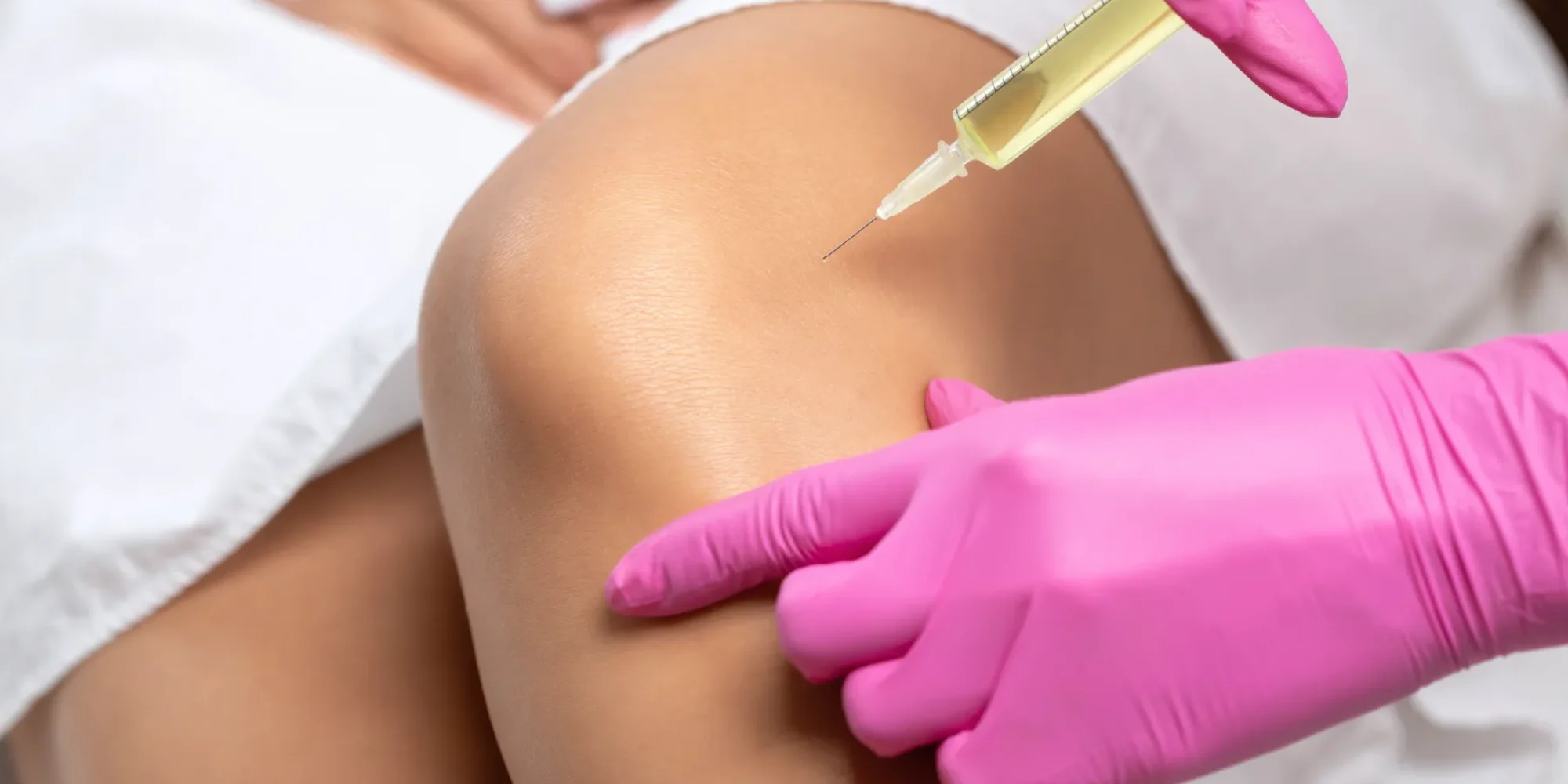 “Stem cell and PRP injections for joints at Gentle Giant Care LLC in Atlanta, Georgia — showing a clinician performing regenerative therapy on a patient’s joints to reduce pain, improve mobility, and promote healing in a clinical setting.”